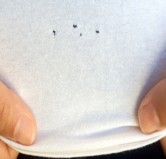 Tr�s receitas caseiras para dar adeus a tra�as e insetos